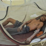 18-year-old Mir Hasan Gadani was seriously injured in the blast, but he says he has no choice but to go back to work at the Gadani shipbreaking yard. Photo: IndustriALL/Amar Guriro