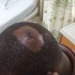 После жестокого разгона рабочих Tarkwa военными, некоторые участники забастовки были ранены